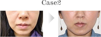 Case2